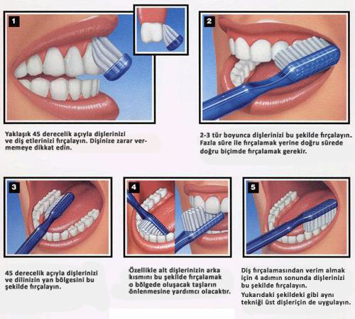 Ağız İçi Sağlığı İçin Diş Fırçalama Teknikleri