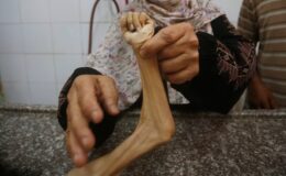 Can kaybının 59 bini aştığı Gazze’de son 24 saatte 19 kişi açlıktan hayatını kaybetti