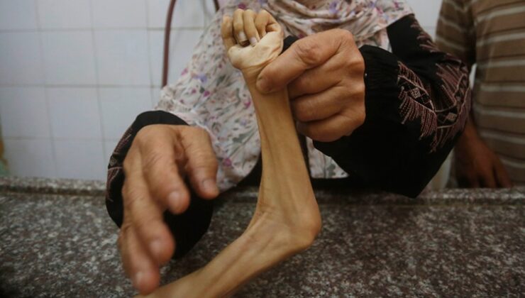 Can kaybının 59 bini aştığı Gazze’de son 24 saatte 19 kişi açlıktan hayatını kaybetti