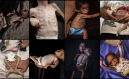 Gazze’de tedavi olamayan çocuklar, hastane köşelerinde ölümle pençeleşiyor