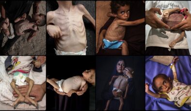 Gazze’de tedavi olamayan çocuklar, hastane köşelerinde ölümle pençeleşiyor