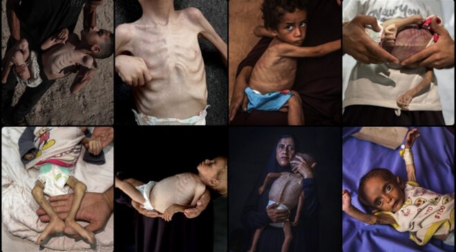 Gazze’de tedavi olamayan çocuklar, hastane köşelerinde ölümle pençeleşiyor