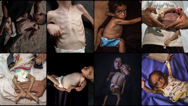 Gazze’de tedavi olamayan çocuklar, hastane köşelerinde ölümle pençeleşiyor