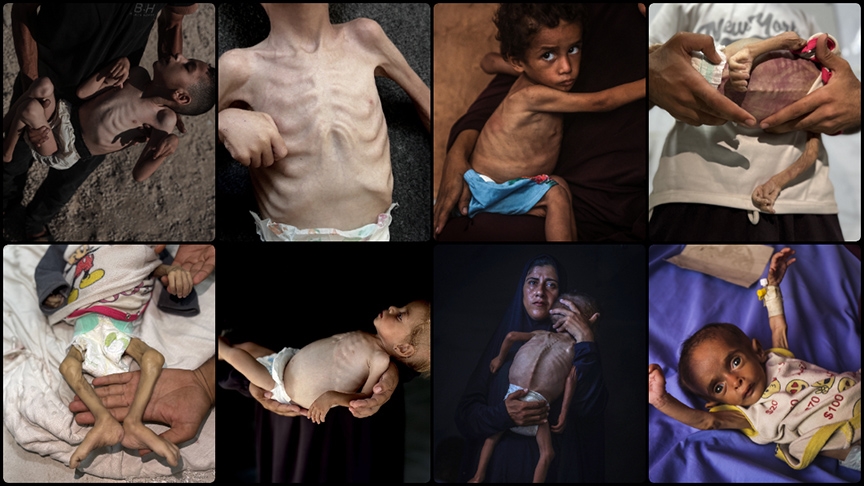 Gazze’de tedavi olamayan çocuklar, hastane köşelerinde ölümle pençeleşiyor